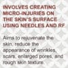 RF Microneedling Facial